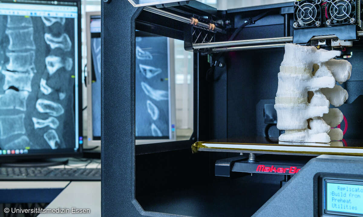 3D Druck