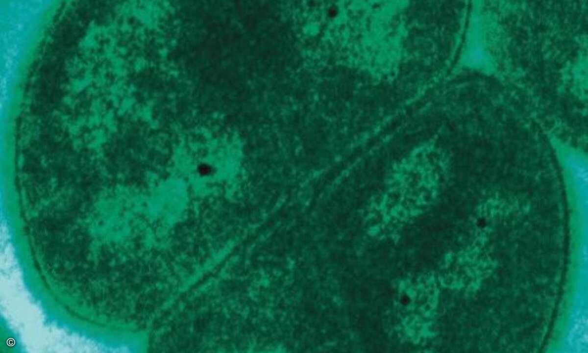 Und zu guter letzt noch ein Blick in die Glaskugel: In nicht allzu ferner Zeit soll sogar ein Bakterium mit dem schönen Namen Deinococcus radiodurans als Datenspeicher in der Informationstechnik genutzt werden. US-amerikanischer Forscher hatten berei