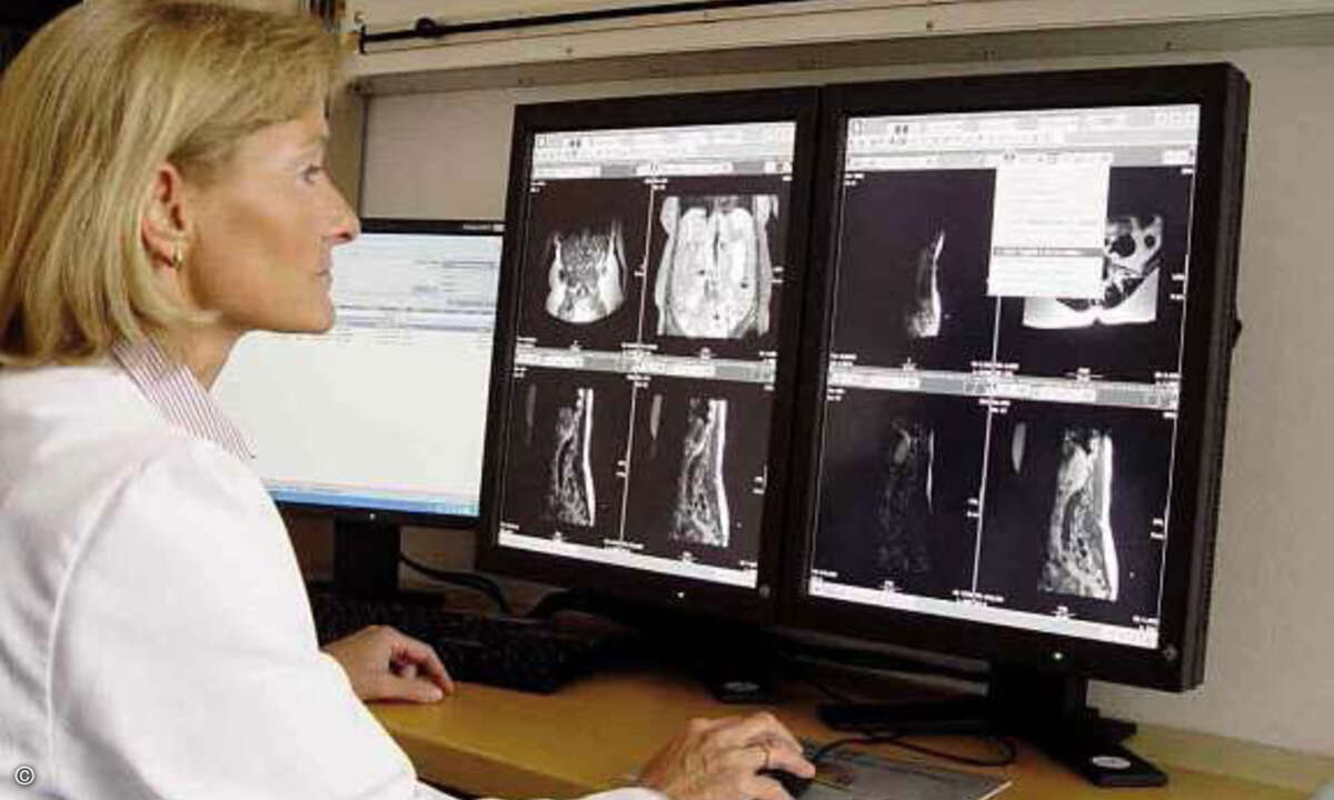 Behandelnde Ärzte greifen auf die gleichen radiologischen Bilder und Befunde zu. Prof. Dr. Andrea Rieber-Brambs, Chefärztin der ­Abteilung für Diagnostische und Interventionelle Radiologie und ­Nuklearmedizin am Städtischen Klinikum München.