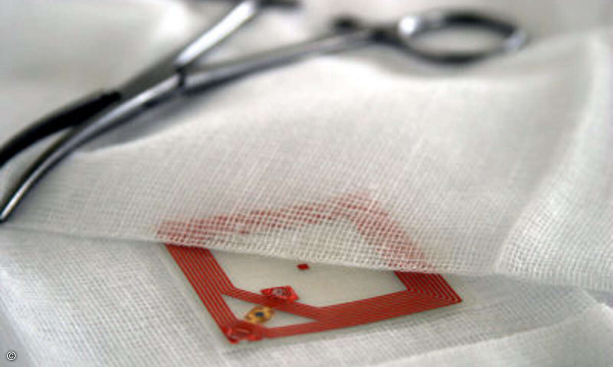 RFID-Tags in OP-Tüchern sind zweifelsfrei im Bauch lokalisierbar, falls sie versehentlich miteingenäht wurden